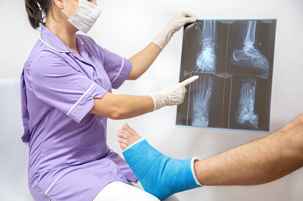 Phẫu thuật Kết hợp Xương Gãy