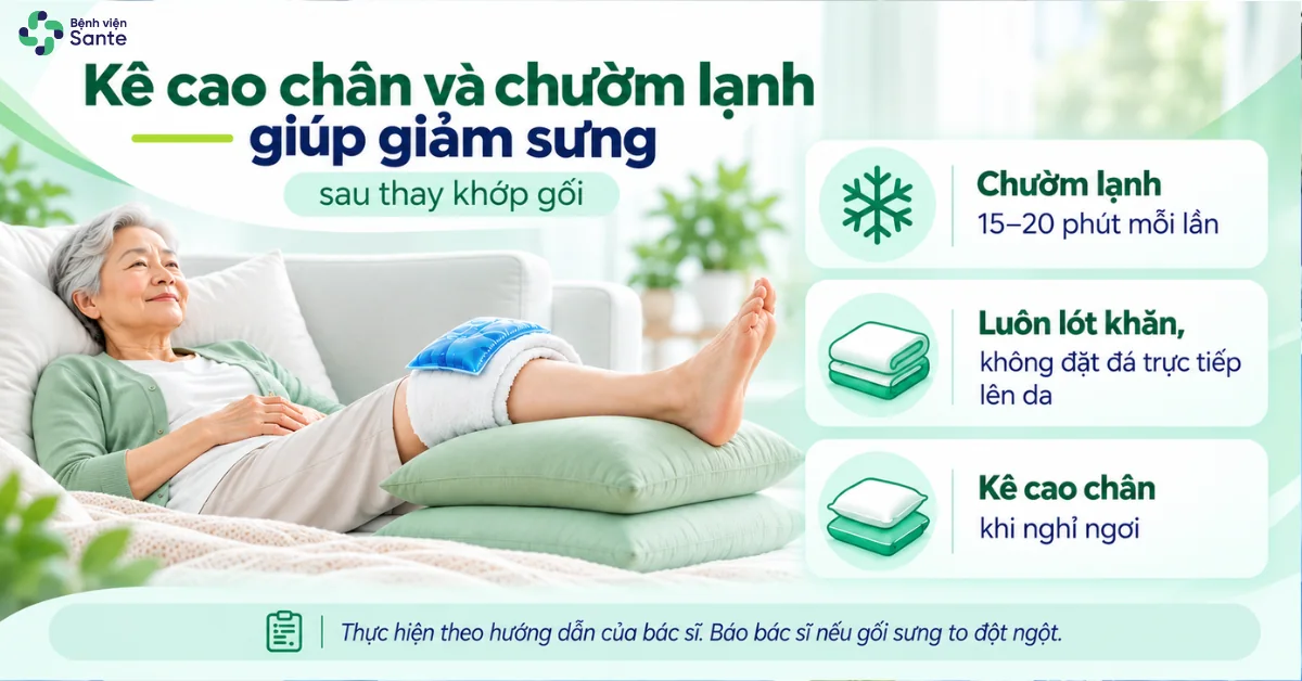 Bệnh viện Sante - Sau Thay Khớp Gối Bao Lâu Thì Đi Được? Các Mốc Phục Hồi & Bài Tập Chuẩn Y Khoa (Hình 4) Kê cao chân và chườm lạnh 15-20 phút đúng cách giúp giảm sưng đau sau mổ thay khớp gối