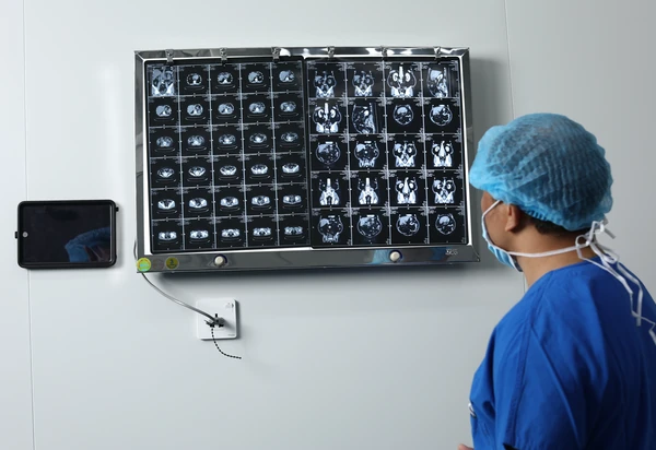 Bác sĩ chuyên khoa Bệnh Viện Đa Khoa Sante đánh giá chi tiết phim chụp và hội chẩn phác đồ tối ưu cùng ekip