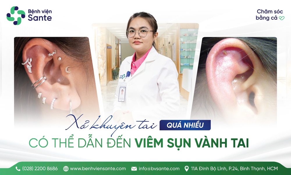 XỎ KHUYÊN TAI QUÁ NHIỀU DẪN ĐẾN VIÊM SỤN VÀNH TAI