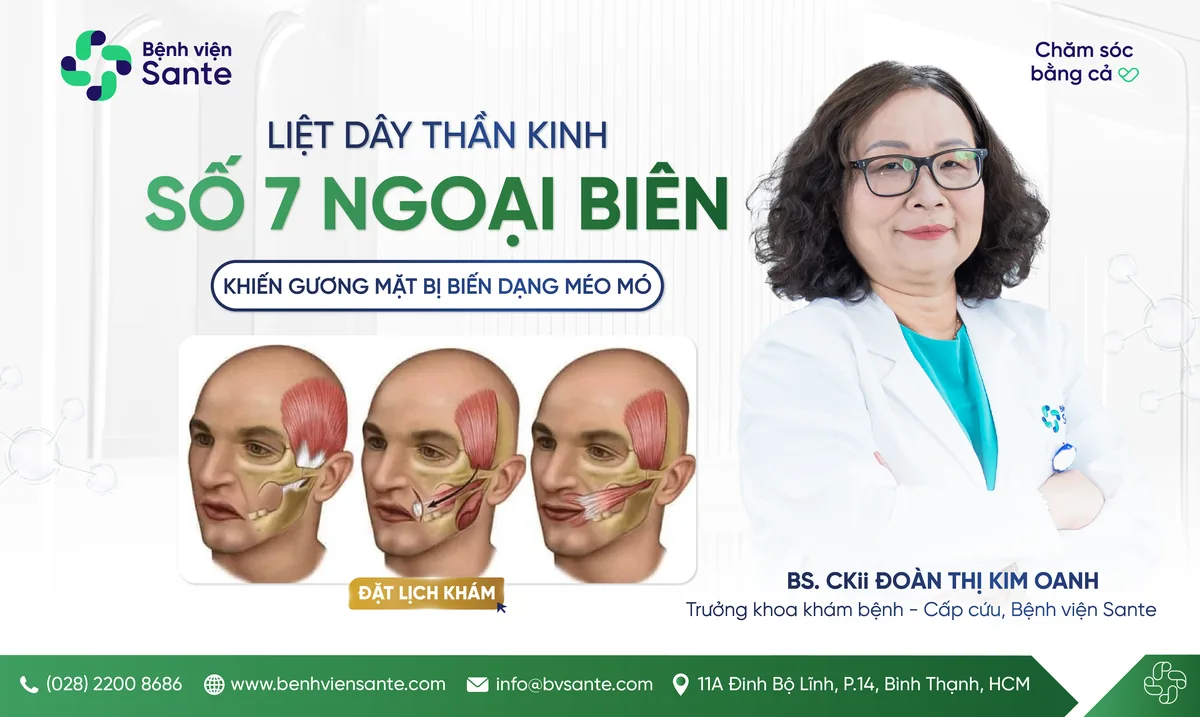 LIỆT DÂY THẦN KINH SỐ 7 NGOẠI BIÊN, MỘT CĂN BỆNH KHIẾN  GƯƠNG MẶT BỊ BIẾN DẠNG - Bệnh viện SANTE Bình Thạnh, TP.HCM