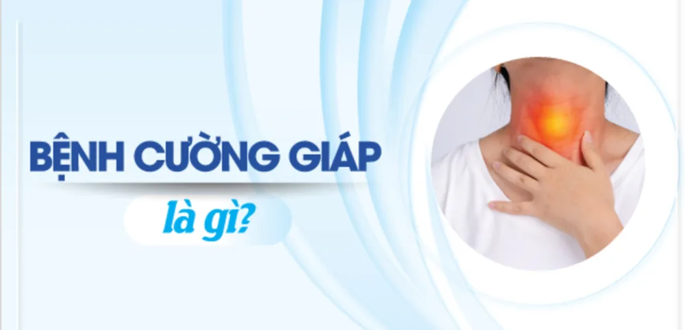 Bệnh viện Sante - Cường giáp là bệnh gì? Nguyên nhân_ dấu hiệu và cách chữa trị (Hình 3)