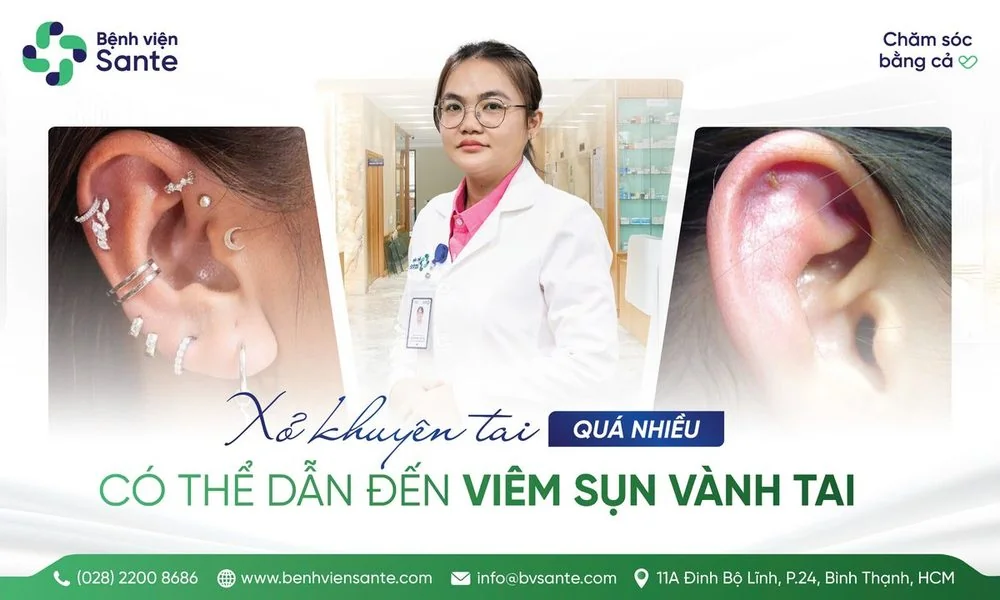 XỎ KHUYÊN TAI QUÁ NHIỀU DẪN ĐẾN VIÊM SỤN VÀNH TAI - Bệnh viện SANTE Bình Thạnh, TP.HCM