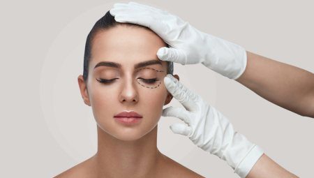 Phẫu thuật tạo hình thẩm mỹ mắt