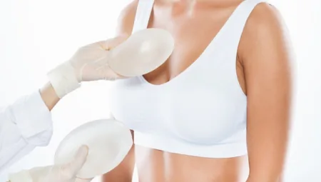 Nâng ngực sa trễ