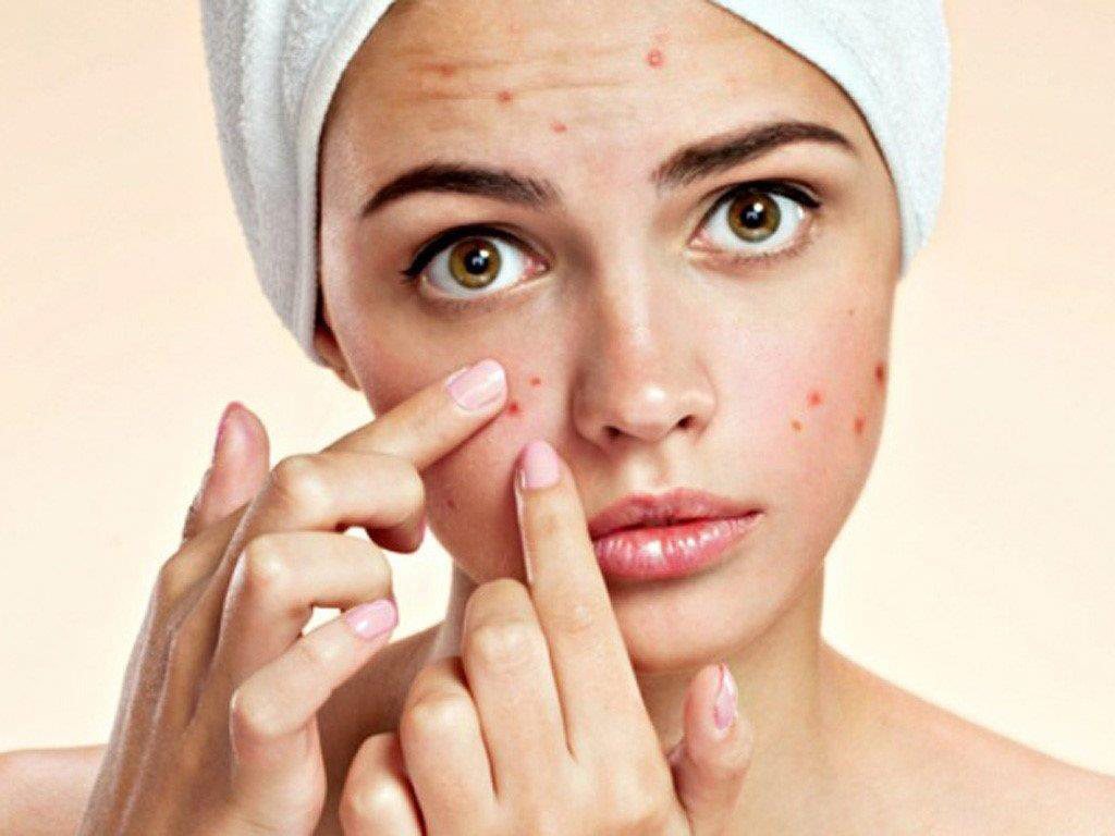 6 bước chăm sóc da mụn thâm hiệu quả, trắng sáng, mịn màng