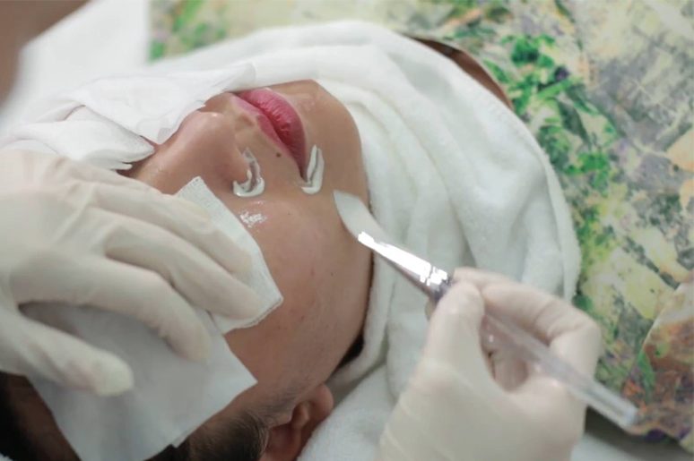 Chăm sóc sau Peel chuẩn đúng quy trình cho da khỏe đẹp hơn