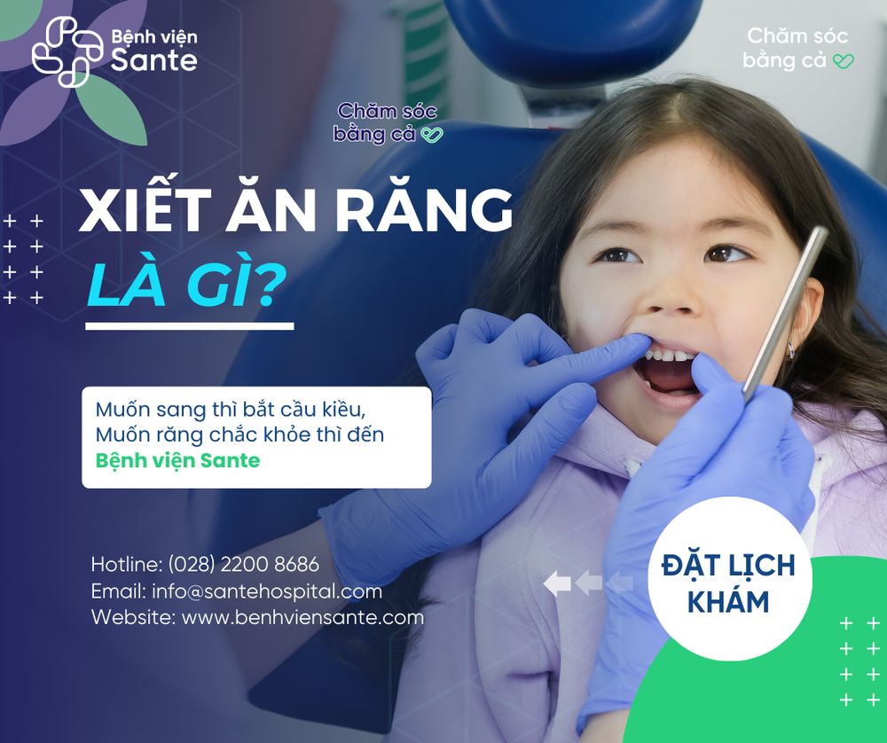 Xiết ăn răng và những điều cần biết