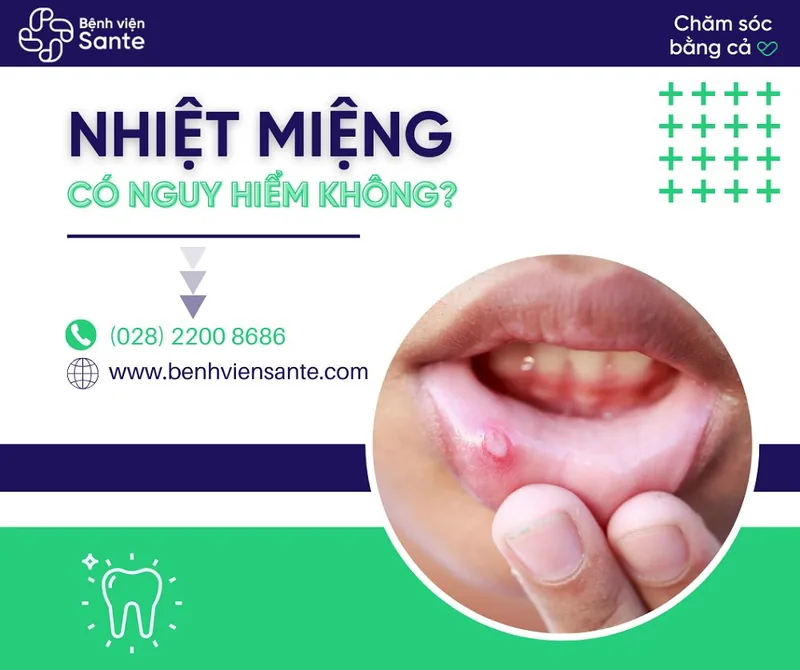 Nhiệt miệng có nguy hiểm không?