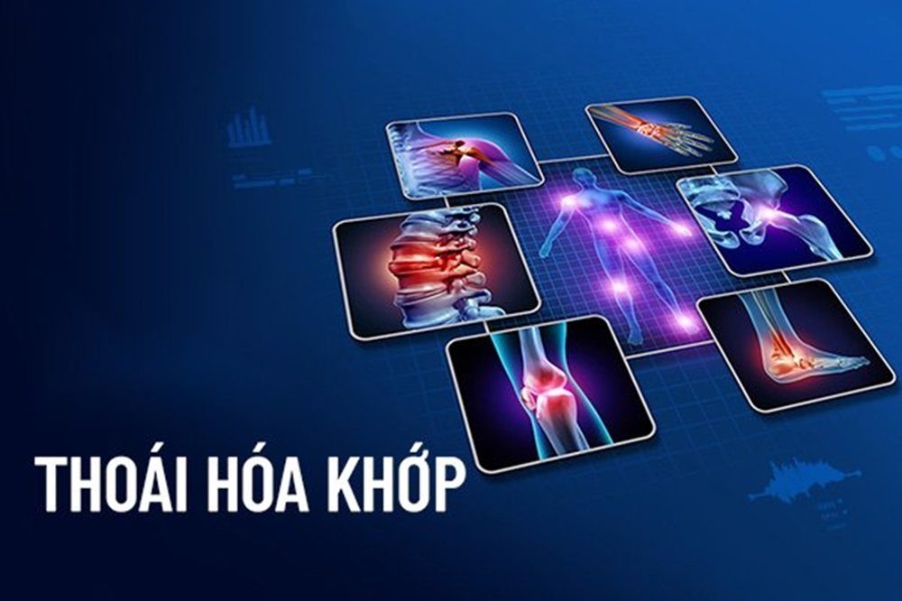 Thoái hóa khớp