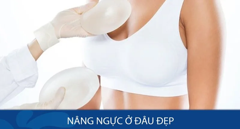 Phẫu thuật nâng ngực ở bệnh viện nào nổi tiếng uy tín chất lượng tại TP.HCM