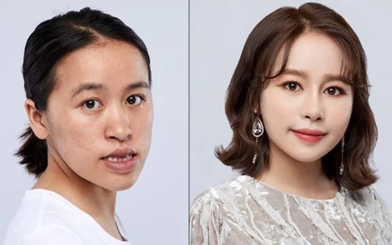 산테 병원 - 얼굴을 완전히 변화시키는 미용 수술 (사진 2)