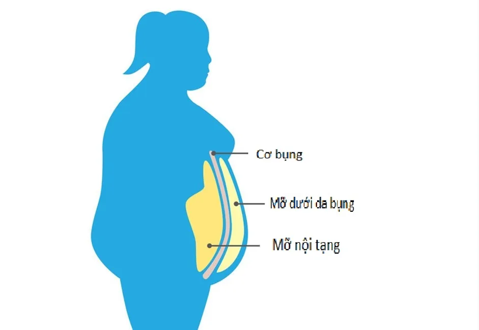 NGUYÊN NHÂN GÂY MỠ NỘI TẠNG - Hình 3 - Bệnh viện SANTE Bình Thạnh, TP.HCM