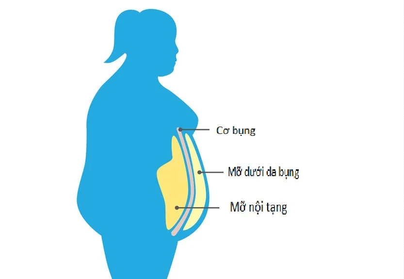 내장지방의 원인 - 이미지 3 - 산테 병원, 호치민시 빈탄