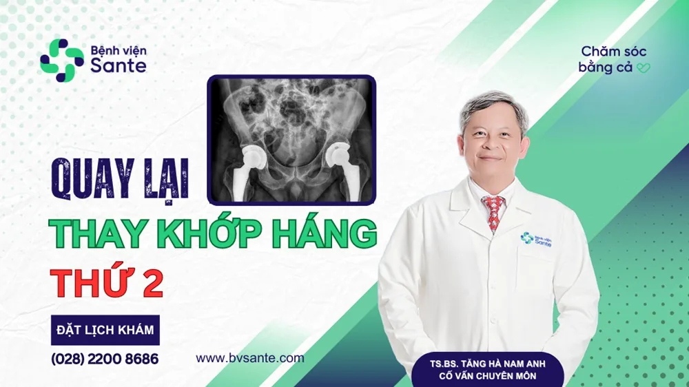 Returning for Contralateral Hip Replacement After 1 Month - SANTE Hospital, Binh Thanh, HCMC