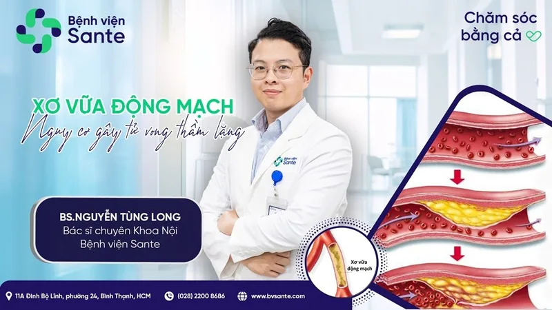 Xơ vữa động mạch - nguy cơ gây tử vong thầm lặng - Bệnh viện SANTE Bình Thạnh, TP.HCM