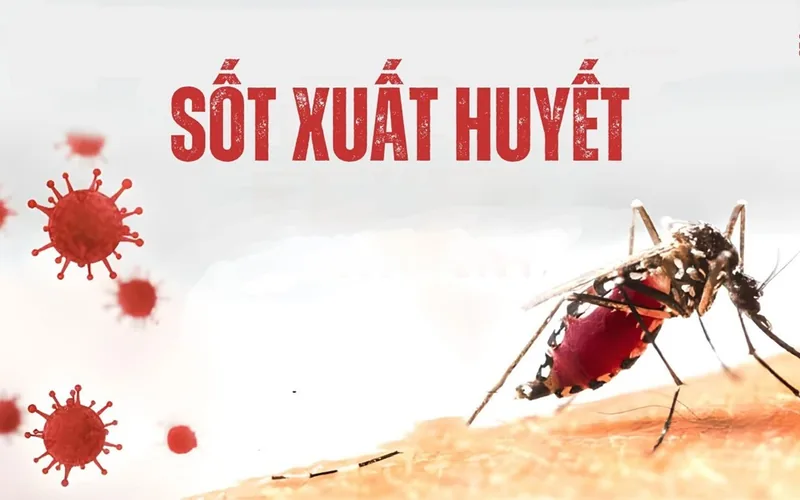 Những điều cần biết về sốt xuất huyết - Bệnh viện SANTE Bình Thạnh, TP.HCM